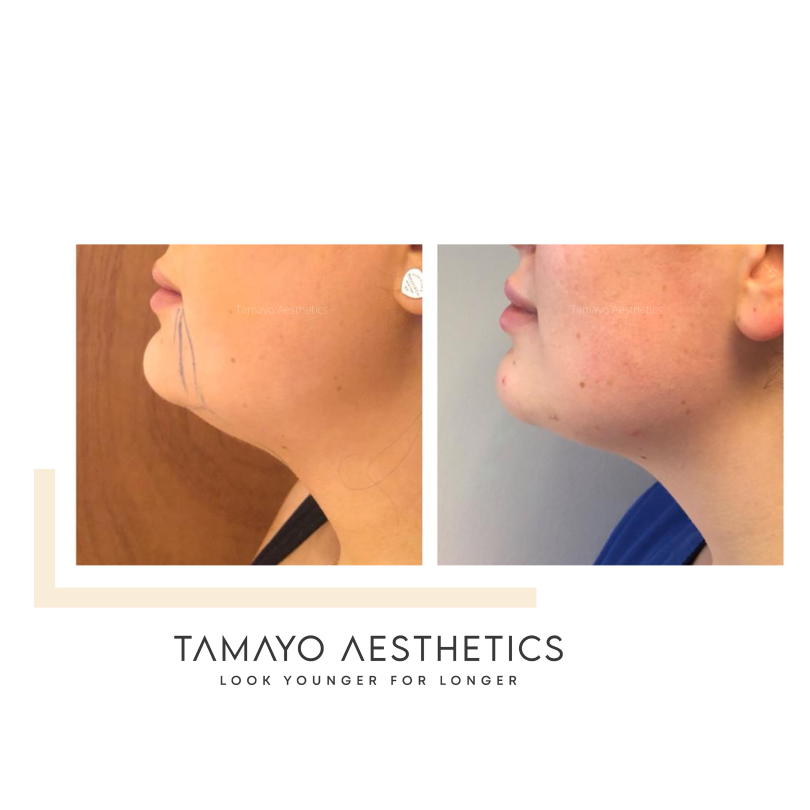 Tamayo-Aesthetics-2-1